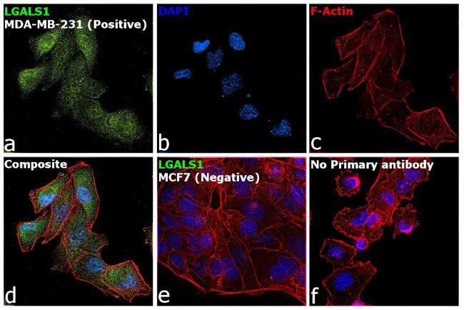 Galectin 1 Antibody in Immunocytochemistry (ICC/IF)