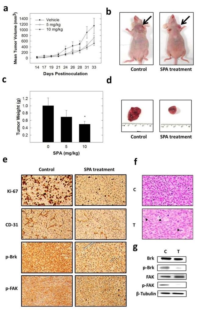 CD31 Antibody in Immunohistochemistry (IHC)