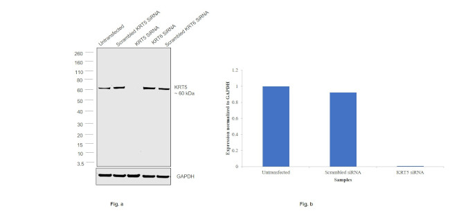 Cytokeratin 5 Antibody