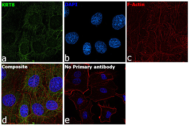 Cytokeratin 8 Antibody in Immunocytochemistry (ICC/IF)