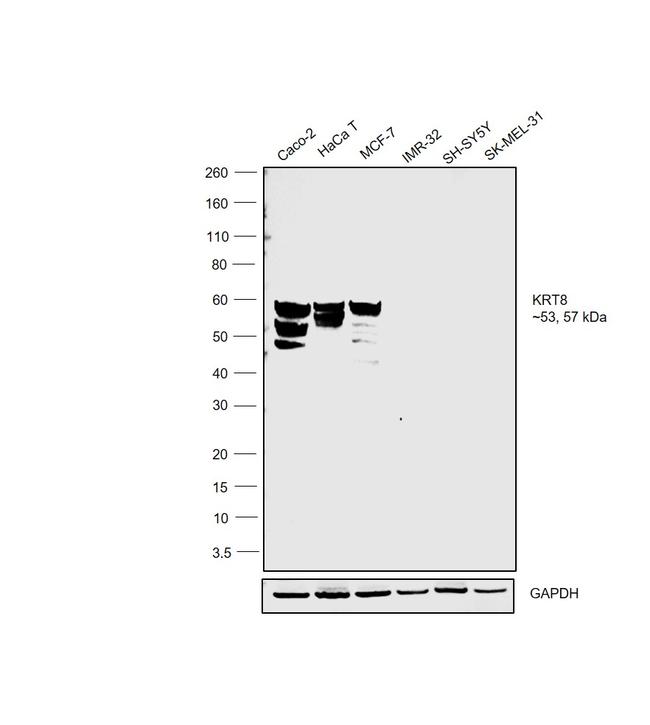 Cytokeratin 8 Antibody in Western Blot (WB)