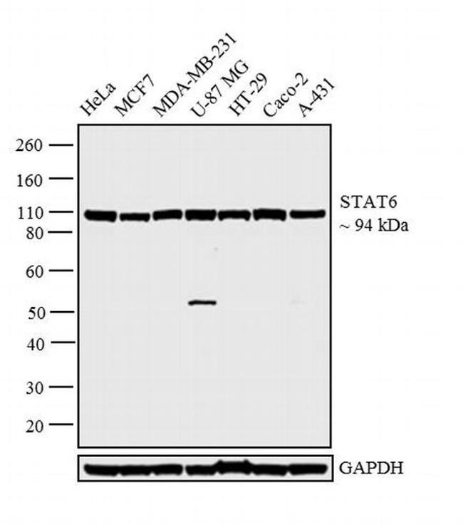 STAT6 Antibody in Western Blot (WB)