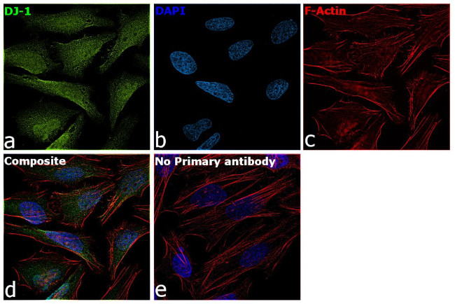 DJ-1 Antibody in Immunocytochemistry (ICC/IF)