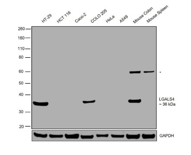 Galectin 4 Antibody in Western Blot (WB)