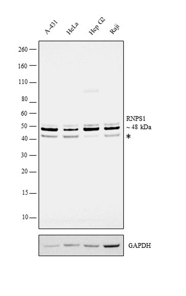 RNPS1 Antibody in Western Blot (WB)