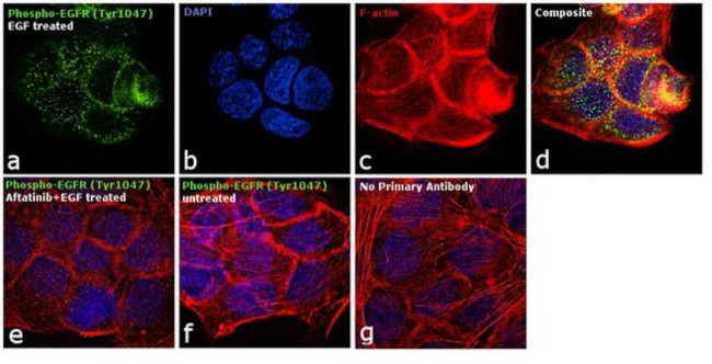 Phospho-EGFR (Ser1047) Antibody in Immunocytochemistry (ICC/IF)