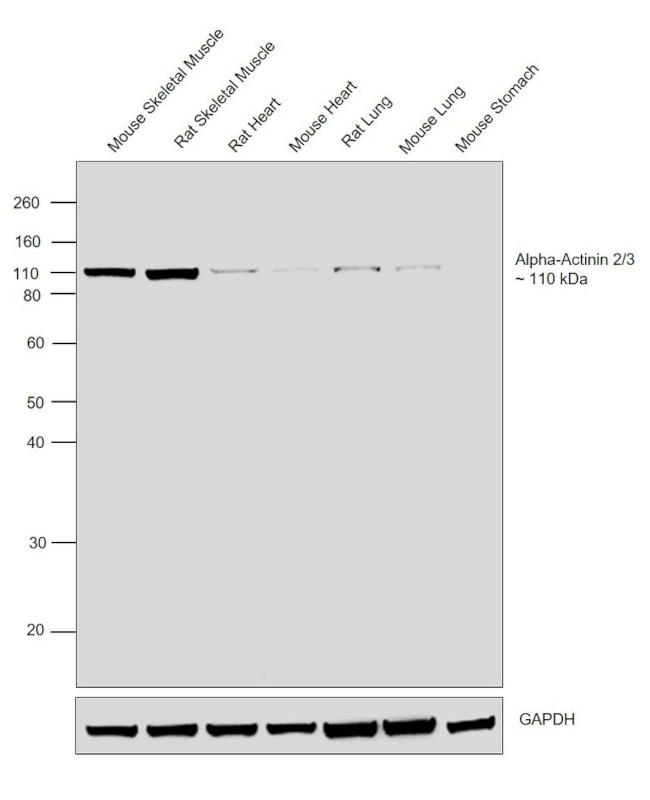 alpha Actinin 2/3 Antibody