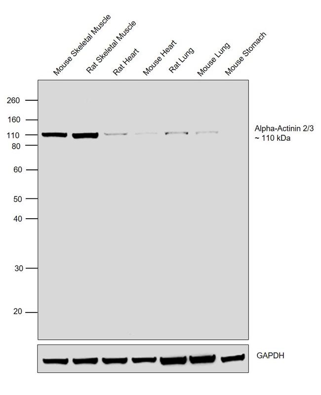 alpha Actinin 2/3 Antibody in Western Blot (WB)