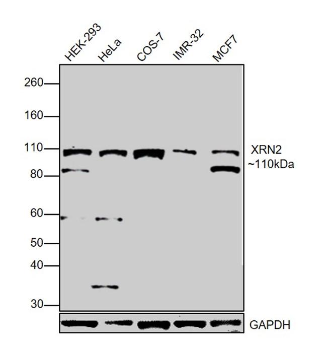 XRN2 Antibody in Western Blot (WB)