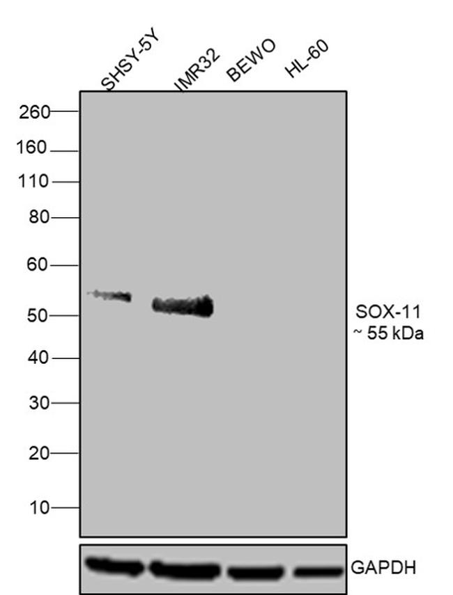 SOX11 Antibody in Western Blot (WB)