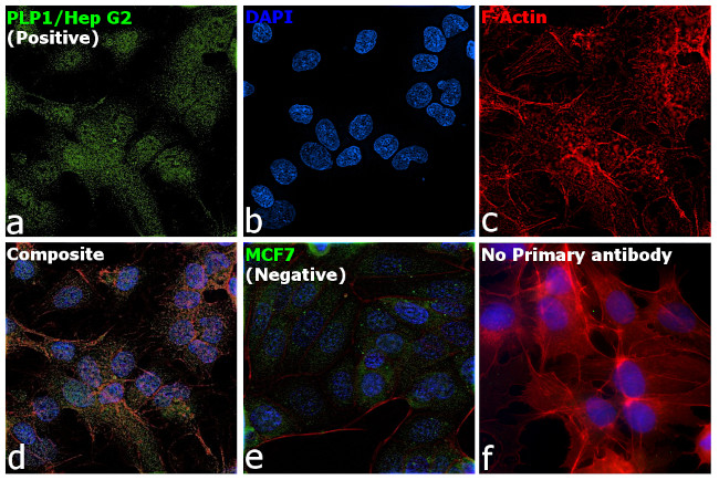 PLP1 Antibody in Immunocytochemistry (ICC/IF)