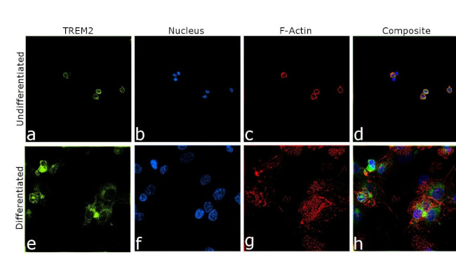 TREM2 Antibody in Immunocytochemistry (ICC/IF)