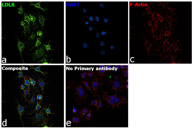 LDLR Antibody in Immunocytochemistry (ICC/IF)