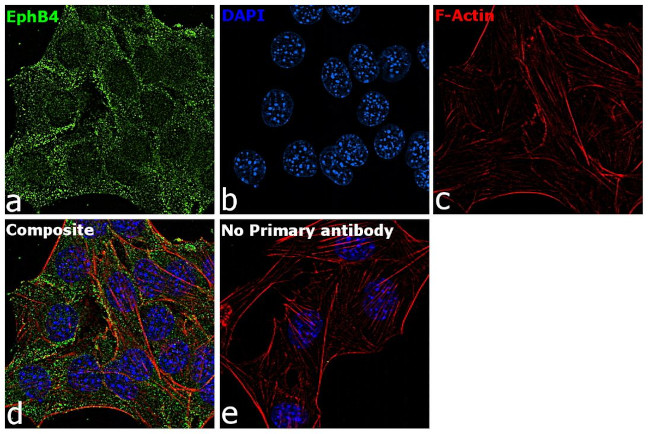 EphB4 Antibody in Immunocytochemistry (ICC/IF)