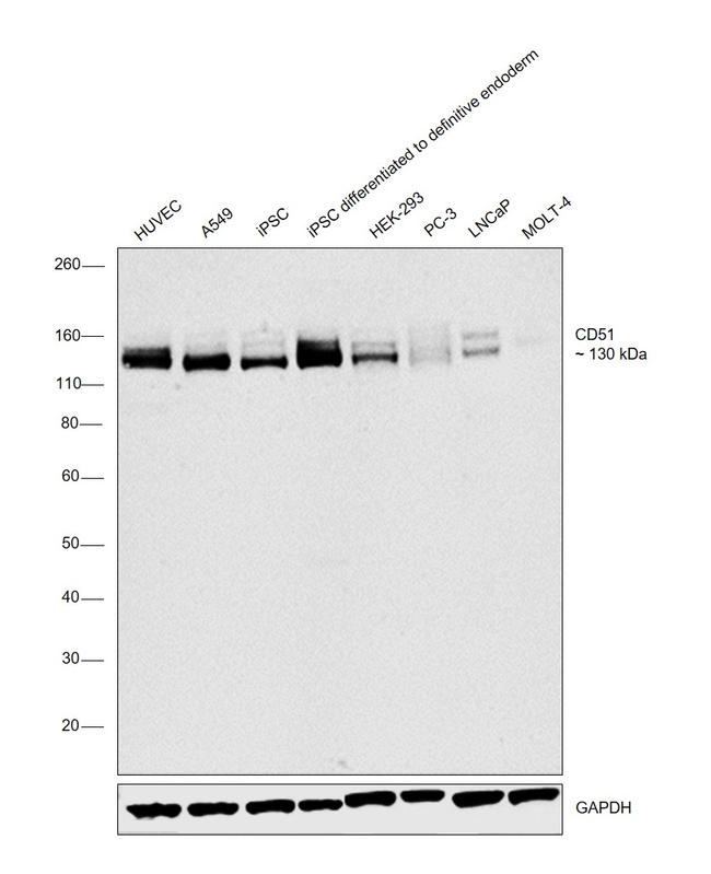 CD51 Antibody in Western Blot (WB)