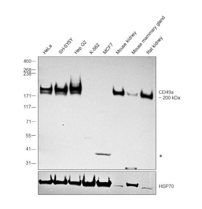 CD49a Antibody