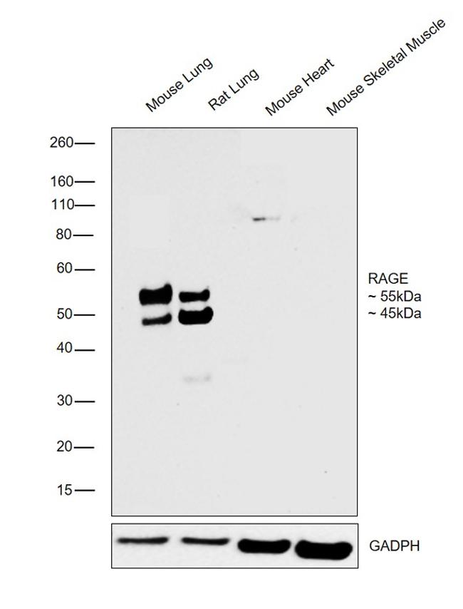 RAGE Antibody in Western Blot (WB)