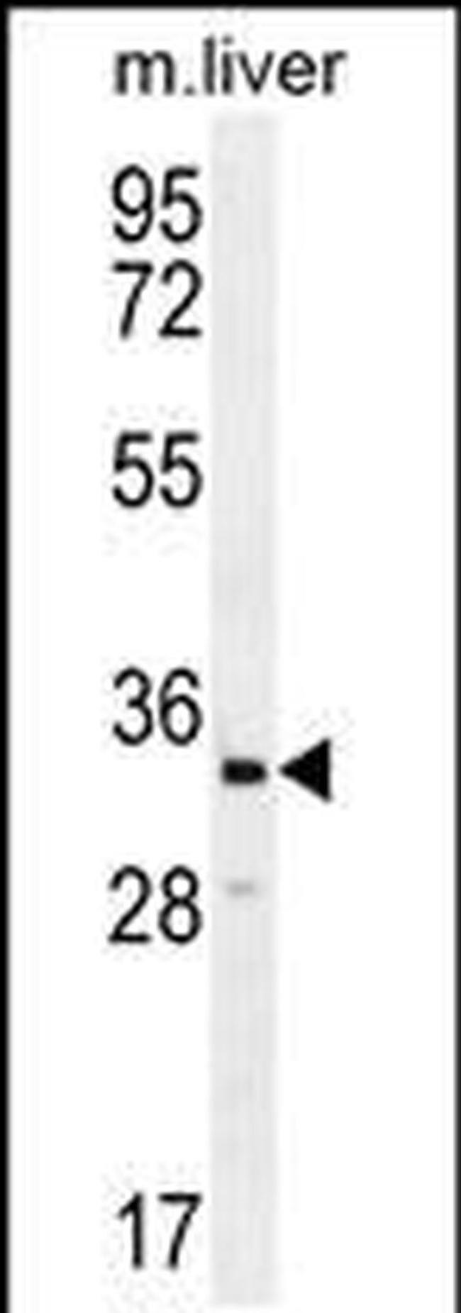 CLVS2 Antibody in Western Blot (WB)