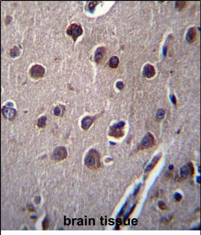 KCTD10 Antibody in Immunohistochemistry (Paraffin) (IHC (P))