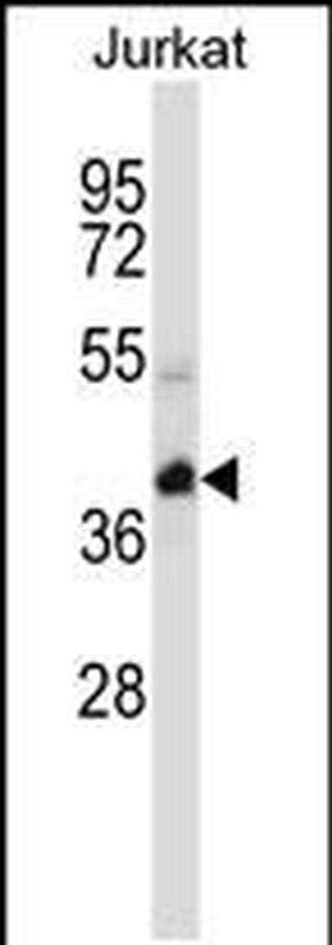 KCTD10 Antibody in Western Blot (WB)