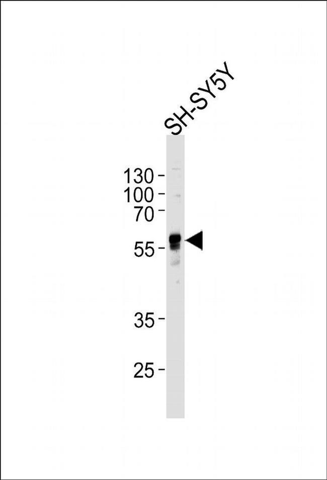 ABHD3 Antibody in Western Blot (WB)