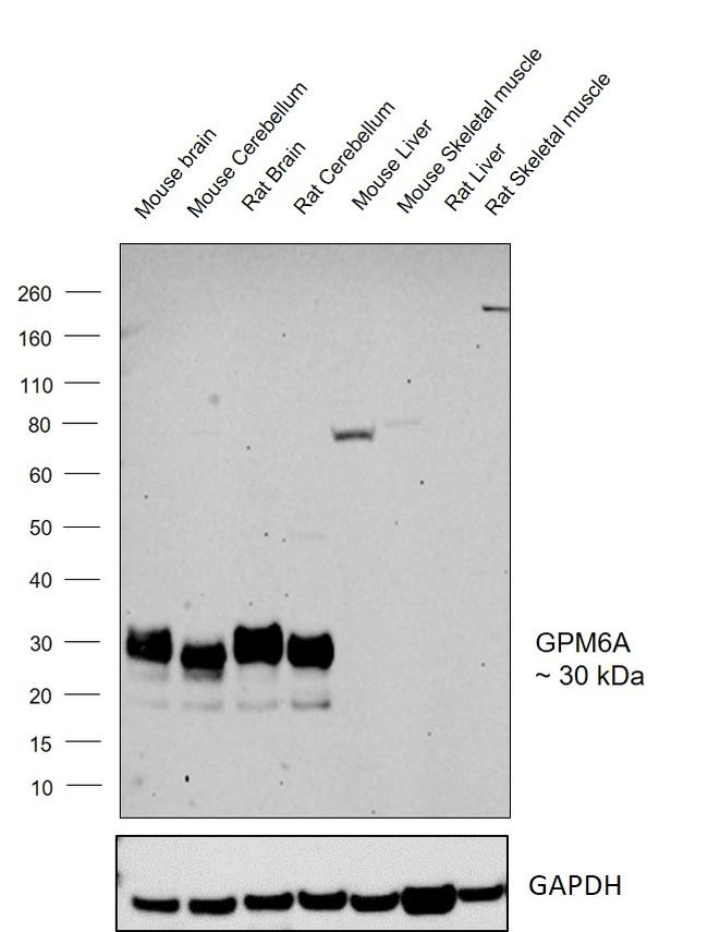 GPM6A Antibody in Western Blot (WB)