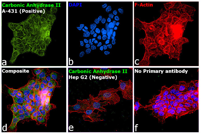 Carbonic Anhydrase II Antibody in Immunocytochemistry (ICC/IF)