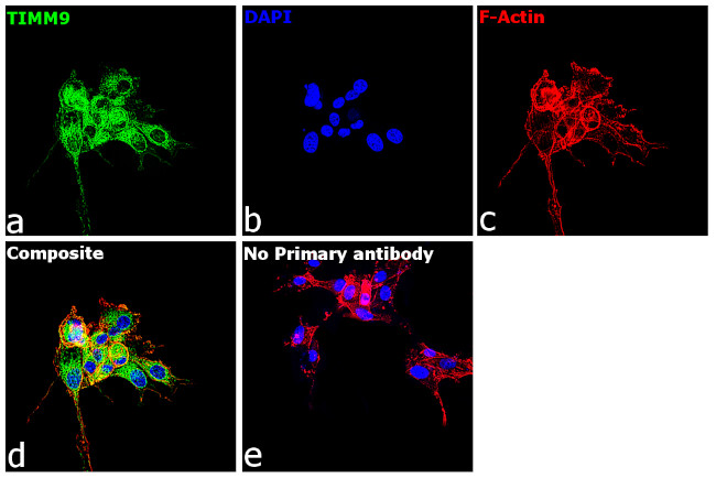 TIMM9 Antibody in Immunocytochemistry (ICC/IF)