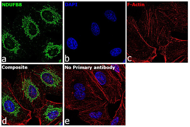 NDUFB8 Antibody in Immunocytochemistry (ICC/IF)