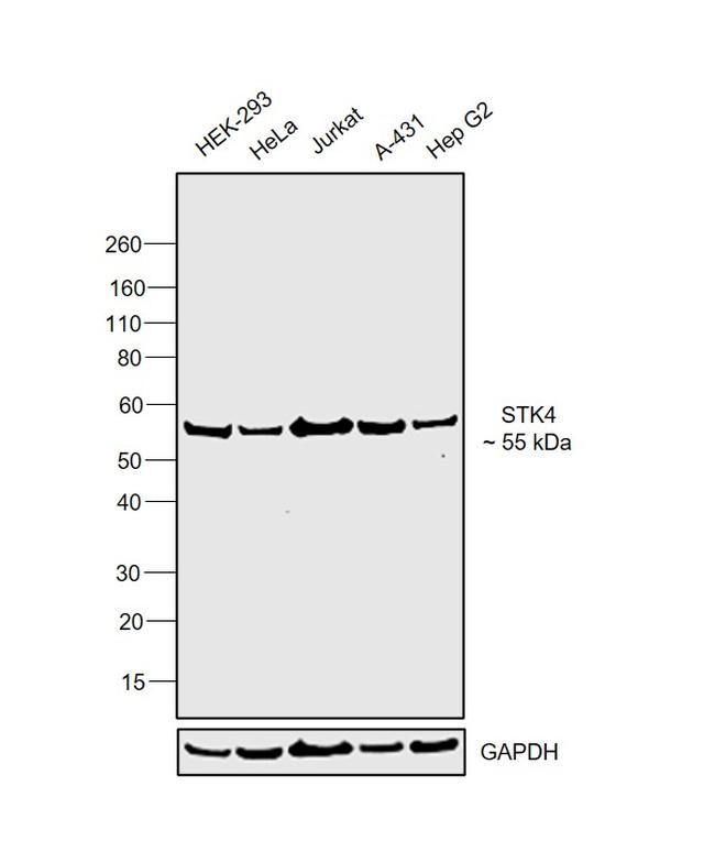 MST1 (STK4) Antibody in Western Blot (WB)