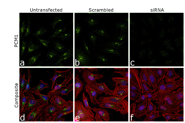 PCM1 Antibody