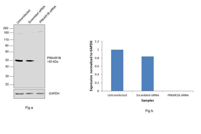 PRKAR1B Antibody in Western Blot (WB)