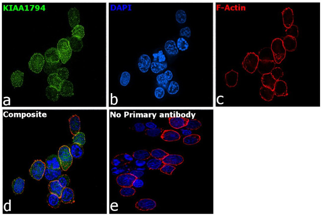 FANCI Antibody in Immunocytochemistry (ICC/IF)