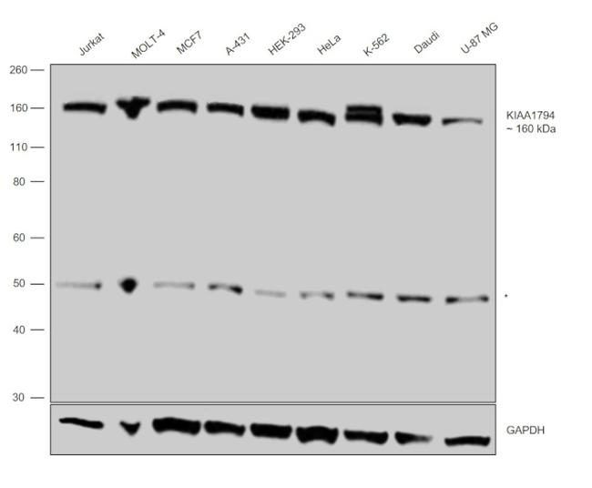 FANCI Antibody in Western Blot (WB)