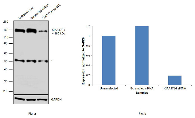 FANCI Antibody