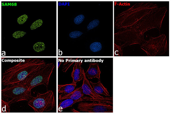 SAM68 Antibody in Immunocytochemistry (ICC/IF)