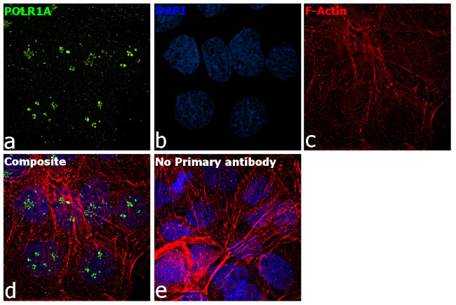 POLR1A Antibody in Immunocytochemistry (ICC/IF)