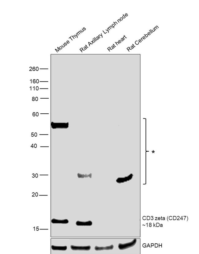 CD3 zeta (CD247) Polyclonal Antibody (PA5-70421)