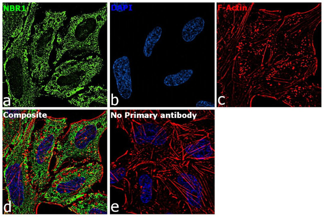 NBR1 Antibody in Immunocytochemistry (ICC/IF)