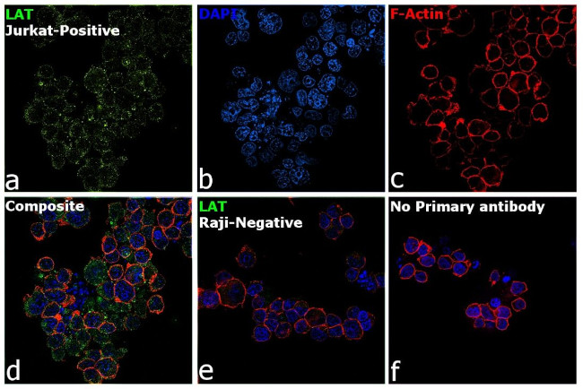 LAT Antibody in Immunocytochemistry (ICC/IF)