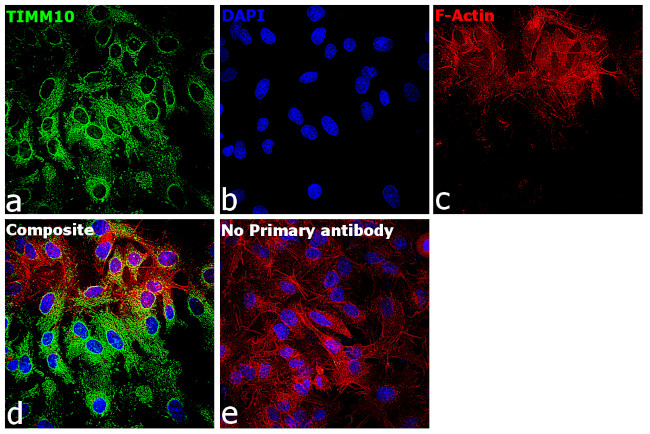 TIMM10 Antibody in Immunocytochemistry (ICC/IF)