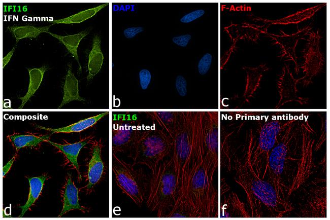 IFI16 Antibody