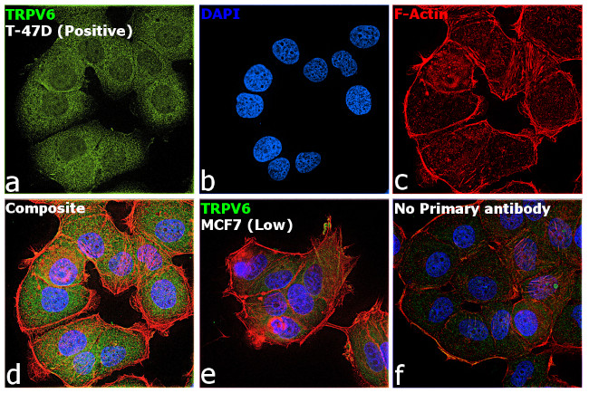 TRPV6 (extracellular) Antibody in Immunocytochemistry (ICC/IF)