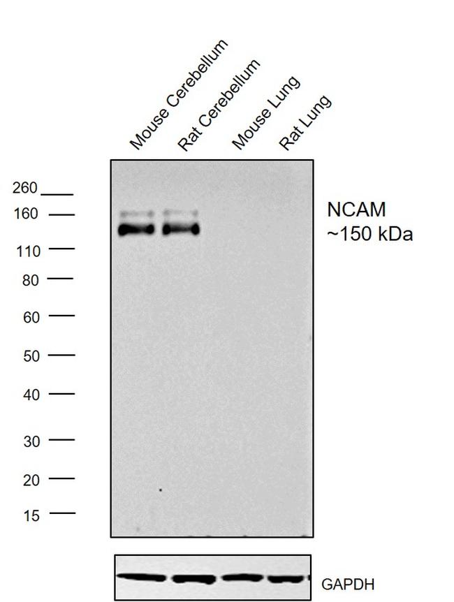 CD56 (NCAM) Antibody in Western Blot (WB)