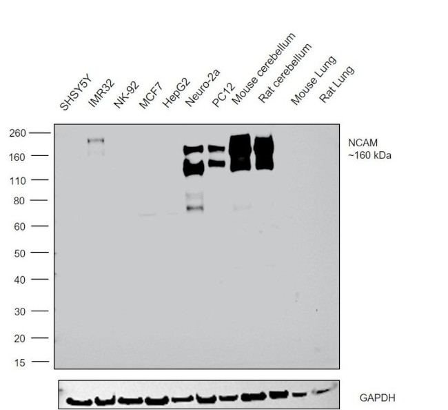 CD56 (NCAM) Antibody