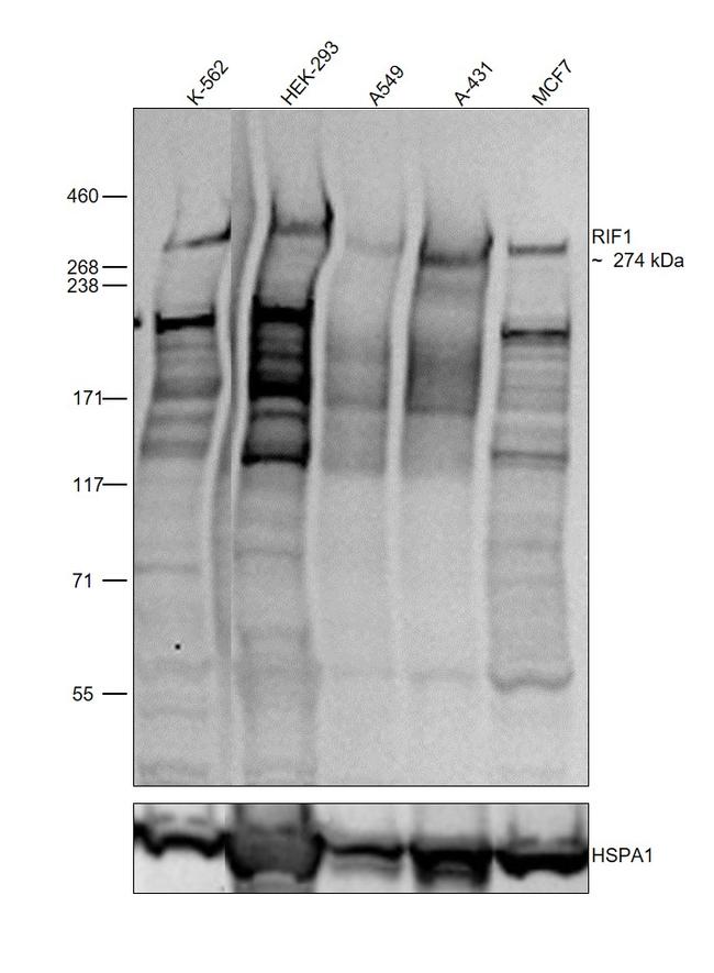 RIF1 Antibody in Western Blot (WB)