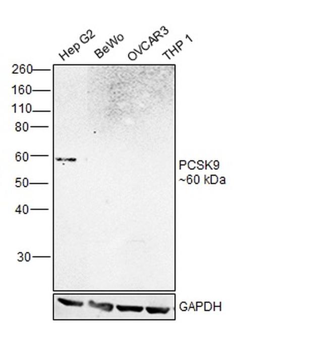 PCSK9 Polyclonal Antibody (PA5-78663)