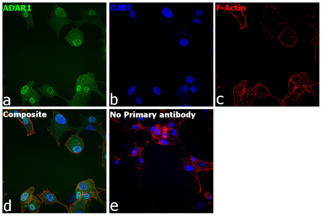 ADAR1 Antibody in Immunocytochemistry (ICC/IF)