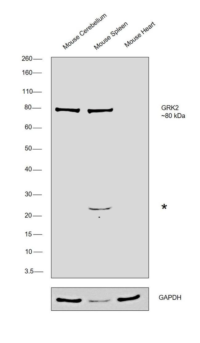 GRK2 Antibody in Western Blot (WB)