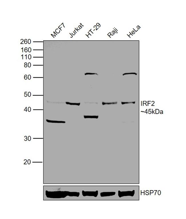 IRF2 Antibody in Western Blot (WB)